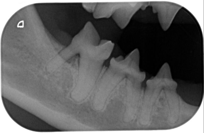 Fig.2 : Rx mandibola sin. pre-op