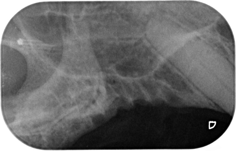 Fig.9 Rx mascella sinistra post-op